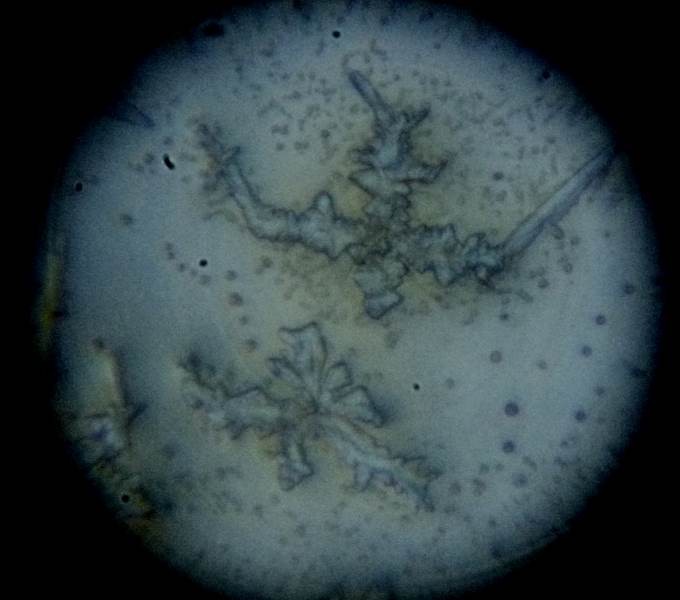 しょうゆの顕微鏡写真